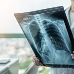 Why A Referral To A Pain Management Specialist May Be Beneficial