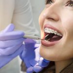 Key Facts About Periodontal Disease from a Dentist