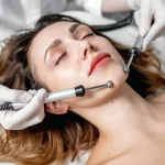 Profhilo Singapore: Next-Level Skin Hydration