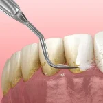 The Process Of Aging Gracefully: The Role Of Plastic Surgery