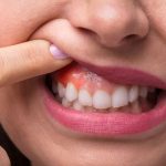 Key Facts About Periodontal Disease from a Dentist