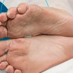 How Pain Management Specialists Manage Neuropathic Pain
