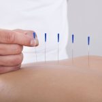 Why Internists Are Crucial In Sports Medicine