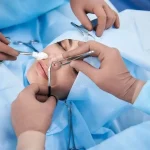 Using Havening Terapi Effectively